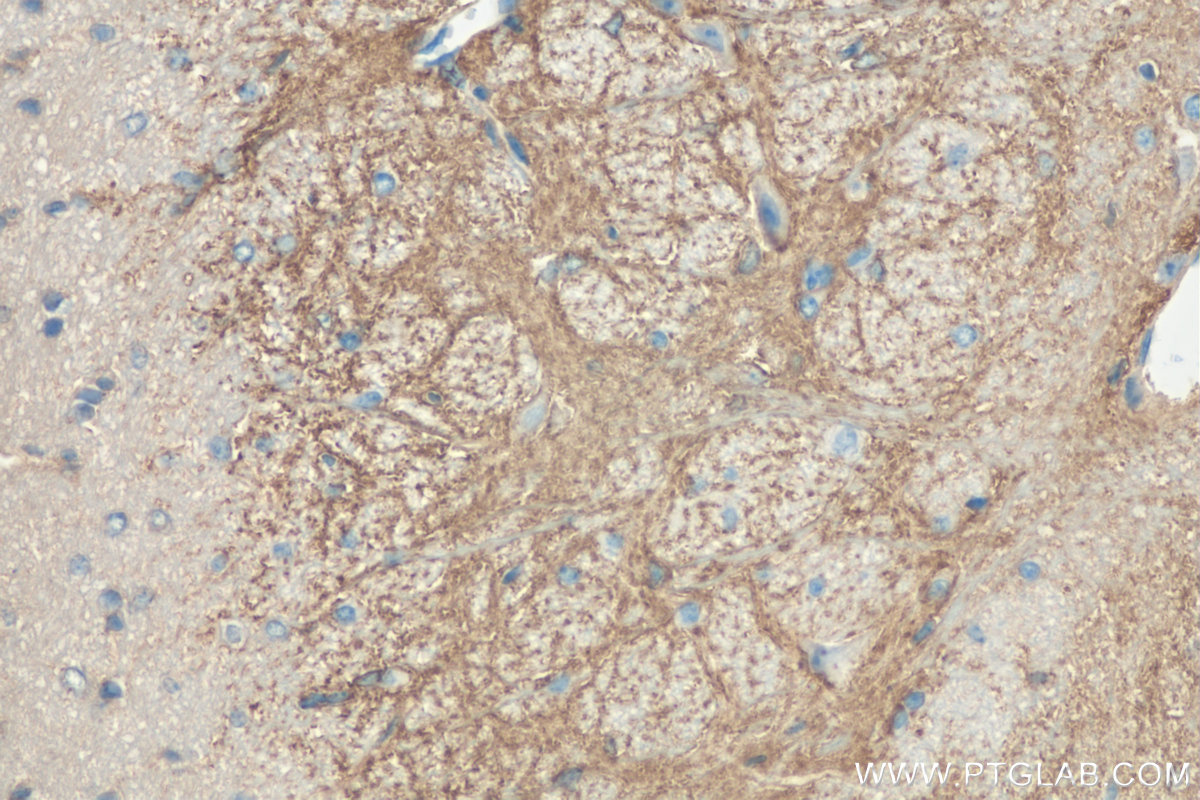 IHC staining of mouse brain using 16117-1-AP