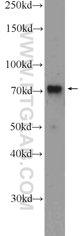 WB analysis of K-562 using 13739-1-AP