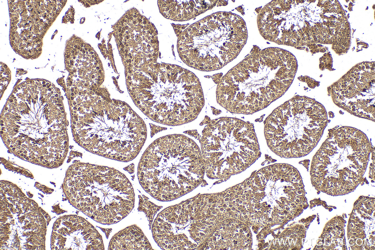 IHC staining of mouse testis using 30042-1-AP