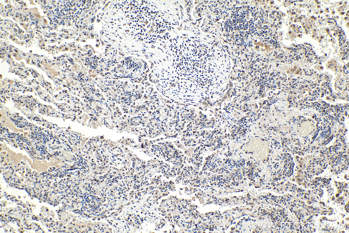 IHC staining of human lung using 11726-2-AP