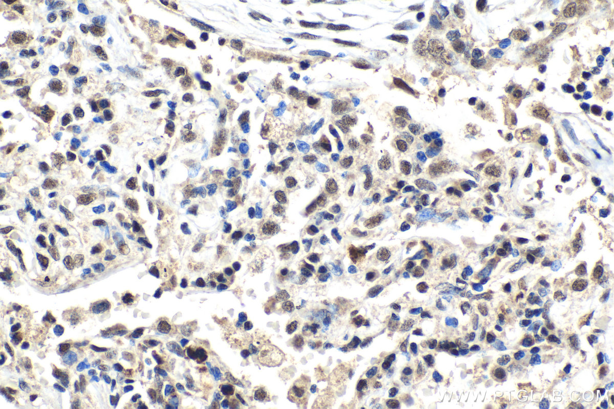 IHC staining of human lung using 11726-2-AP