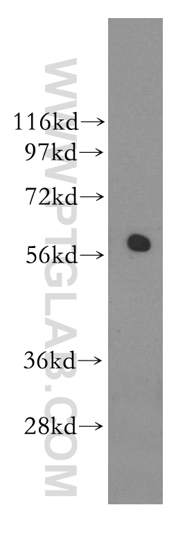 WB analysis of mouse testis using 11364-1-AP