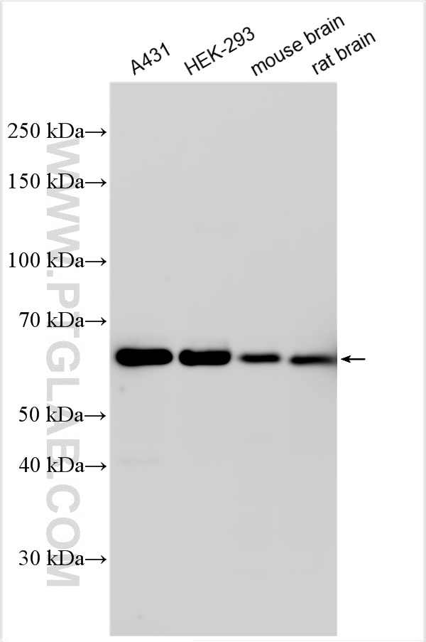 WB analysis using 12121-1-AP