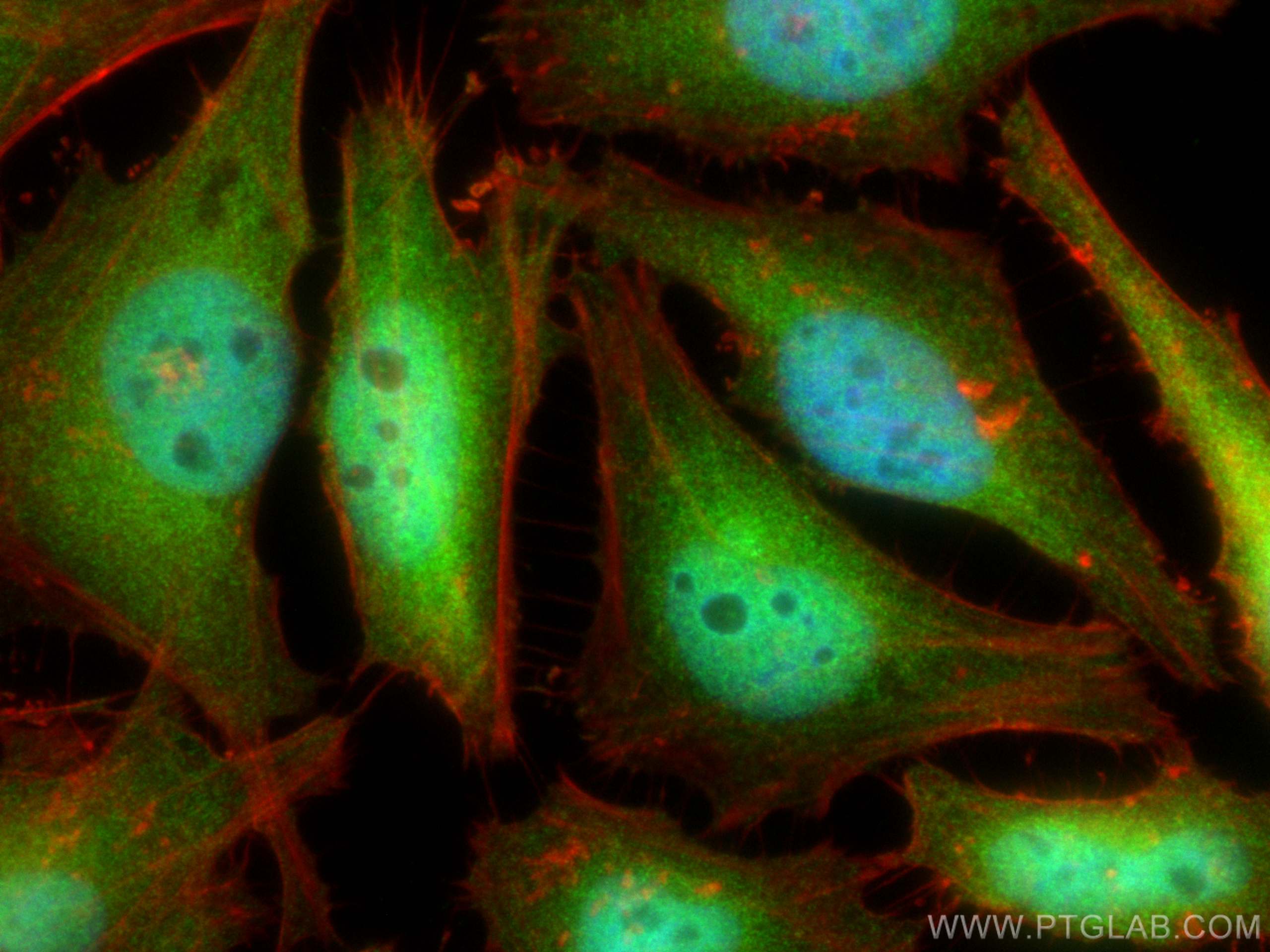 IF Staining of HeLa using 67988-1-Ig (same clone as 67988-1-PBS)