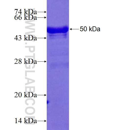 RAD51AP1 fusion protein Ag28385 SDS-PAGE