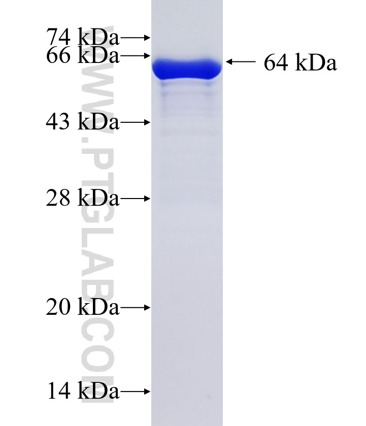 RAD51C fusion protein Ag35070 SDS-PAGE