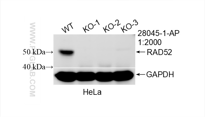 WB analysis of HeLa using 28045-1-AP