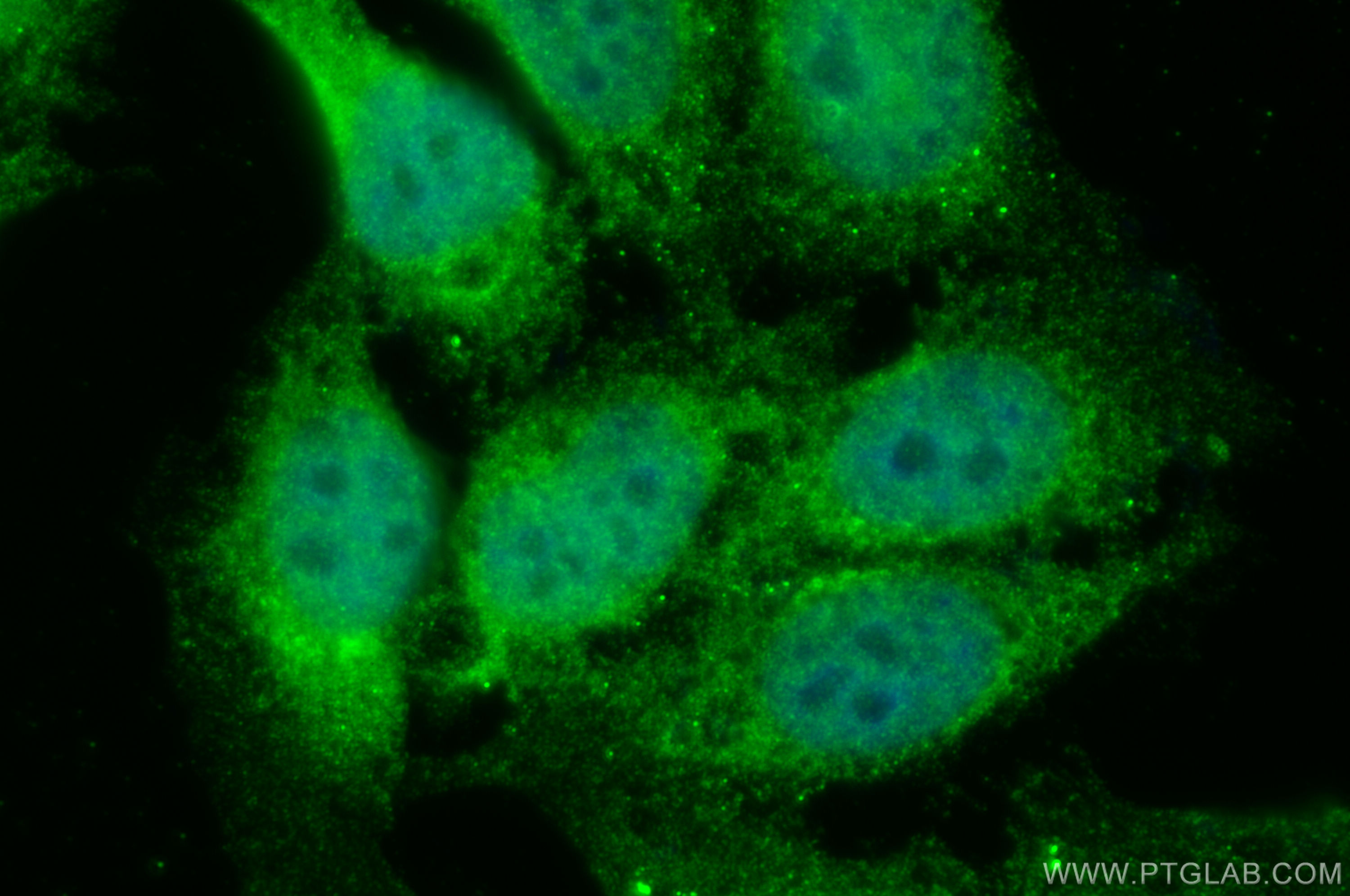 IF Staining of HepG2 using 20491-1-AP