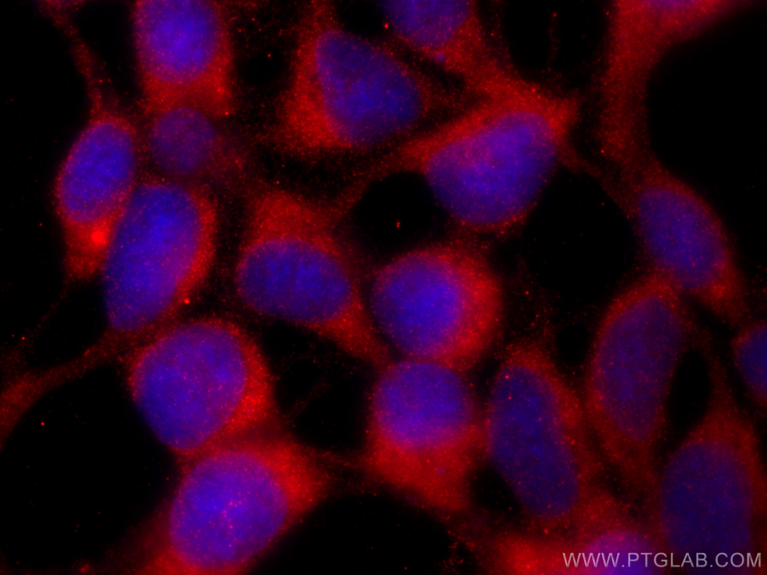 IF Staining of HEK-293 using 66592-1-Ig (same clone as 66592-1-PBS)