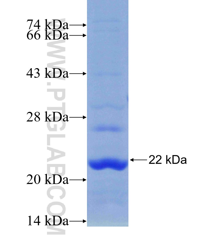 RAG1 fusion protein Ag30192 SDS-PAGE