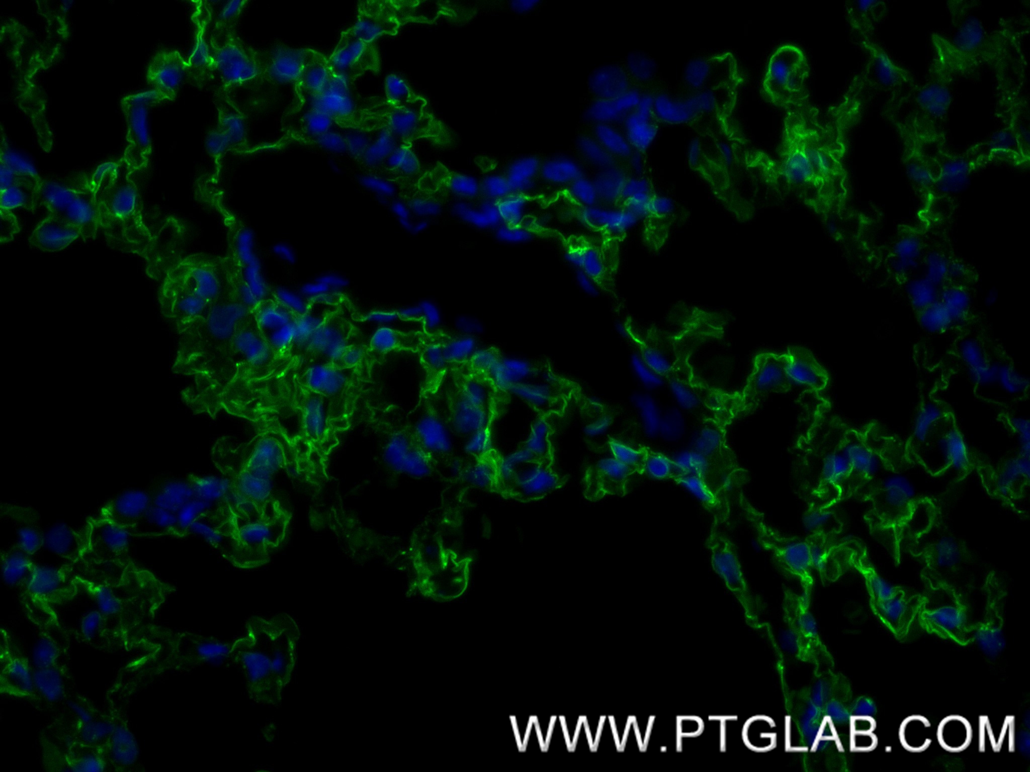 IF Staining of mouse lung using 83742-5-RR (same clone as 83742-5-PBS)