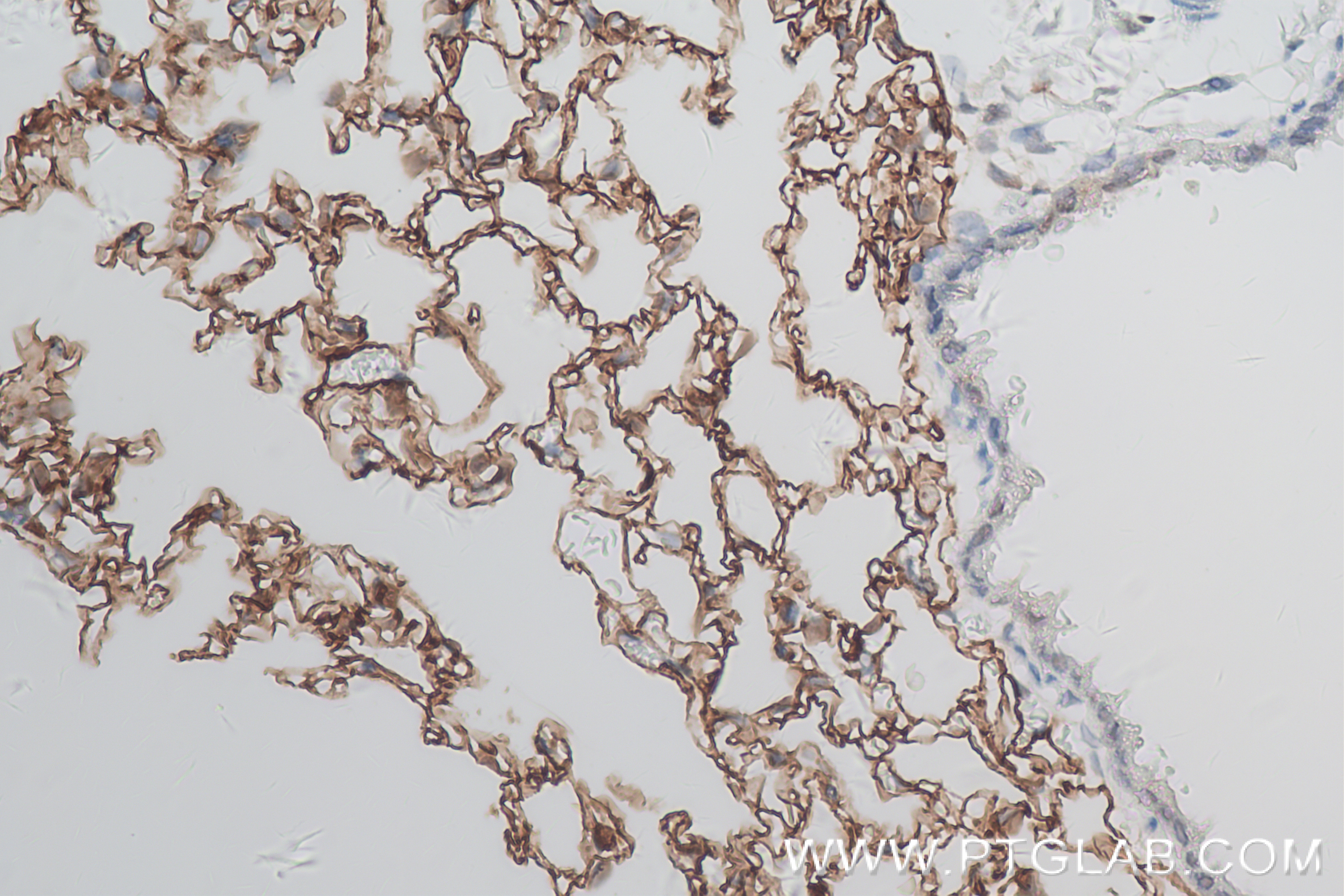 IHC staining of mouse lung using 83742-5-RR