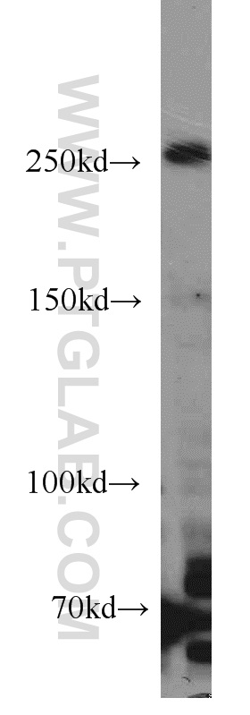 WB analysis of HeLa using 17084-1-AP