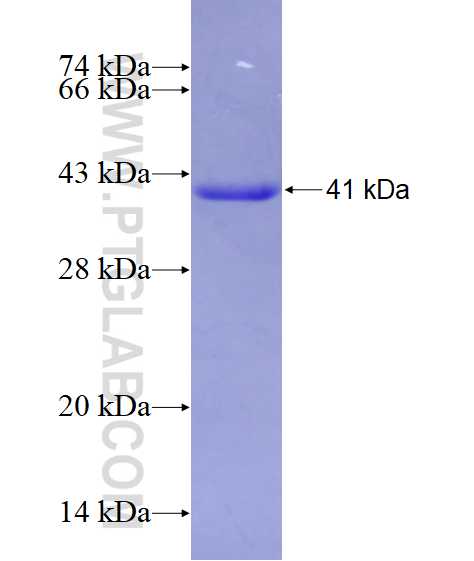 RAI2 fusion protein Ag28240 SDS-PAGE