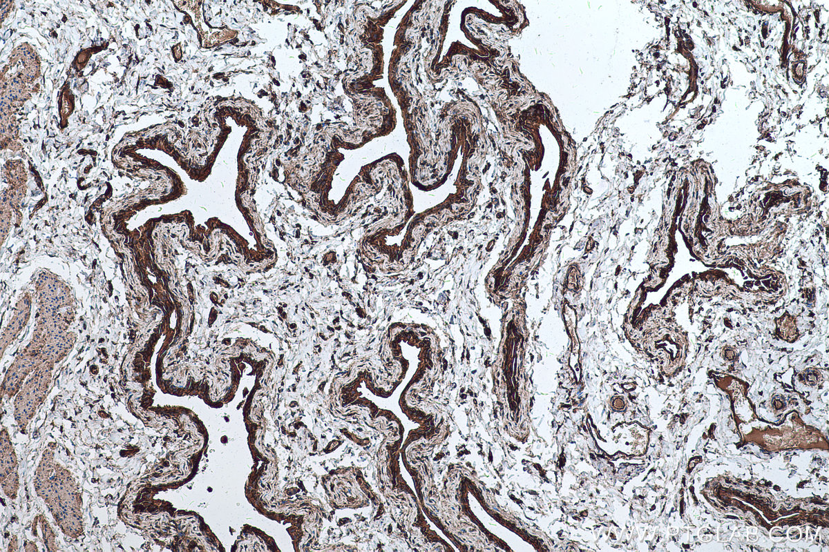 IHC staining of mouse bladder using 67094-1-Ig (same clone as 67094-1-PBS)