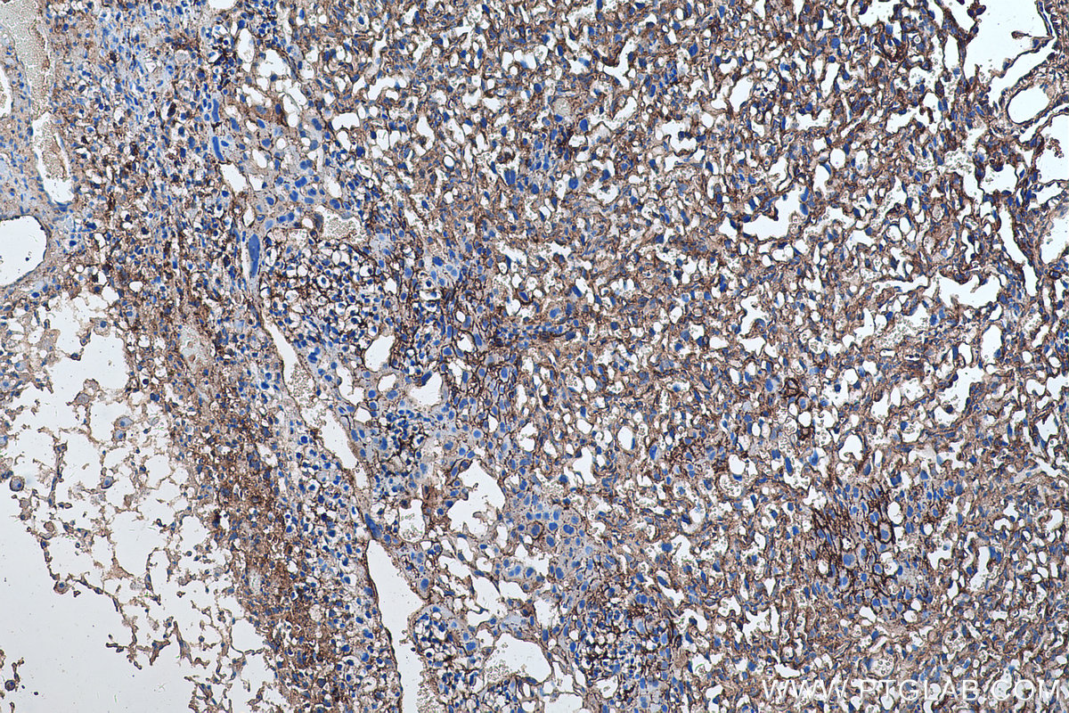 IHC staining of mouse placenta using 67094-1-Ig (same clone as 67094-1-PBS)