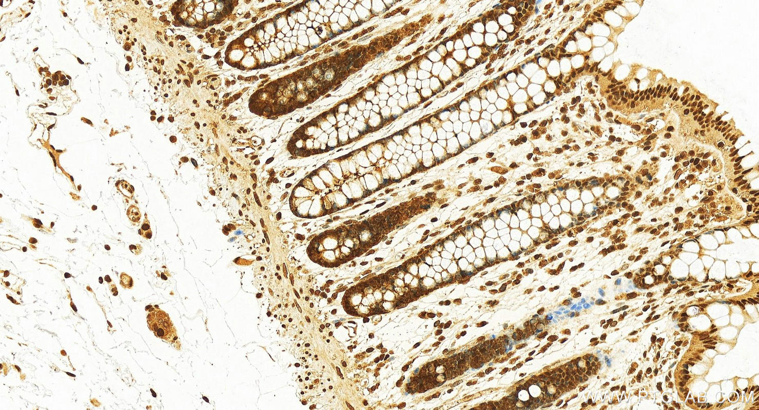 IHC staining of human colon using 10469-1-AP