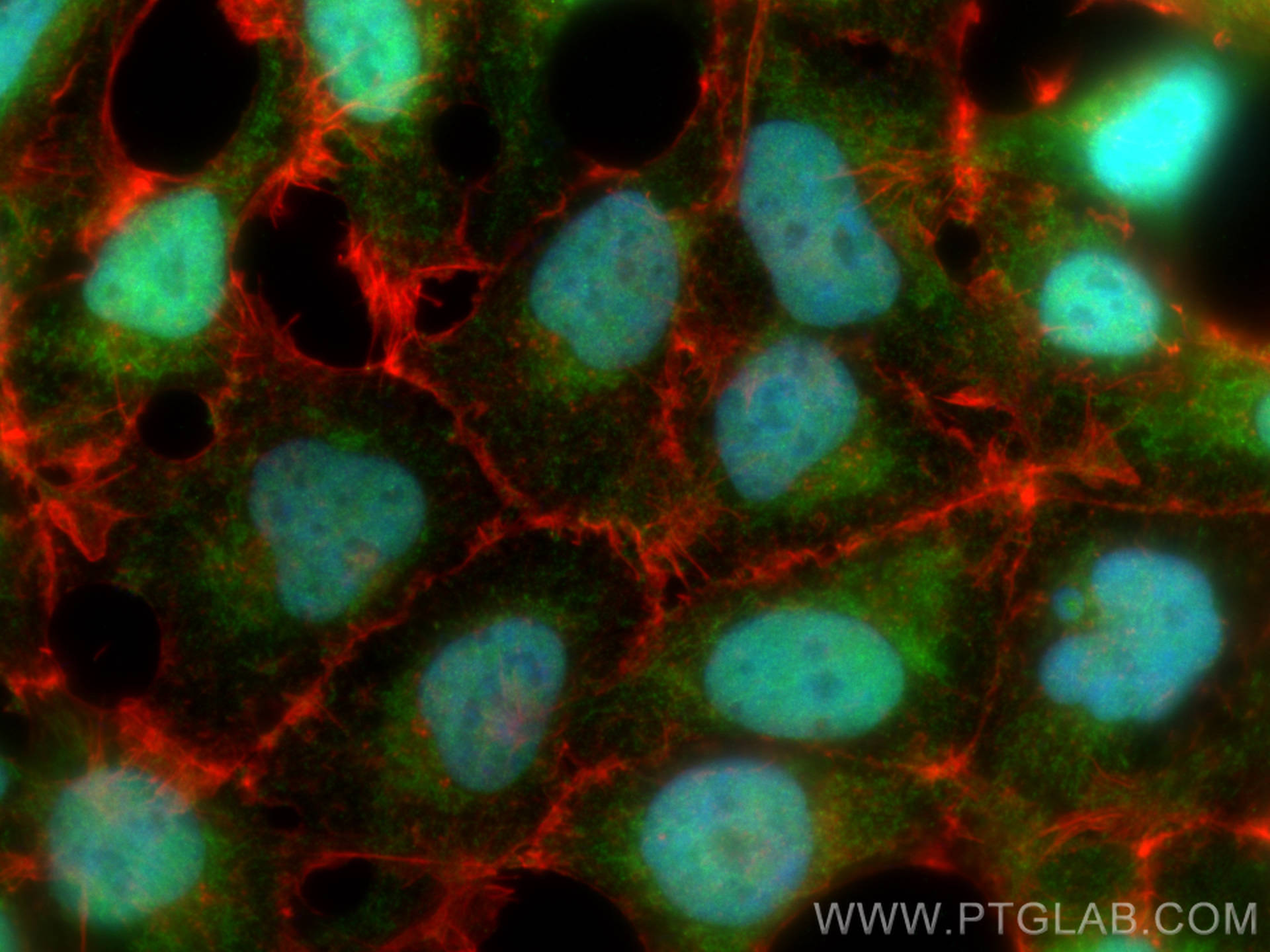 IF Staining of HEK-293 using 10469-1-AP