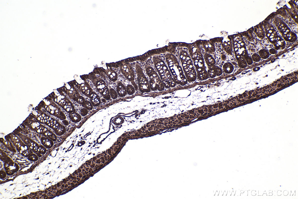 IHC staining of rat colon using 10469-1-AP