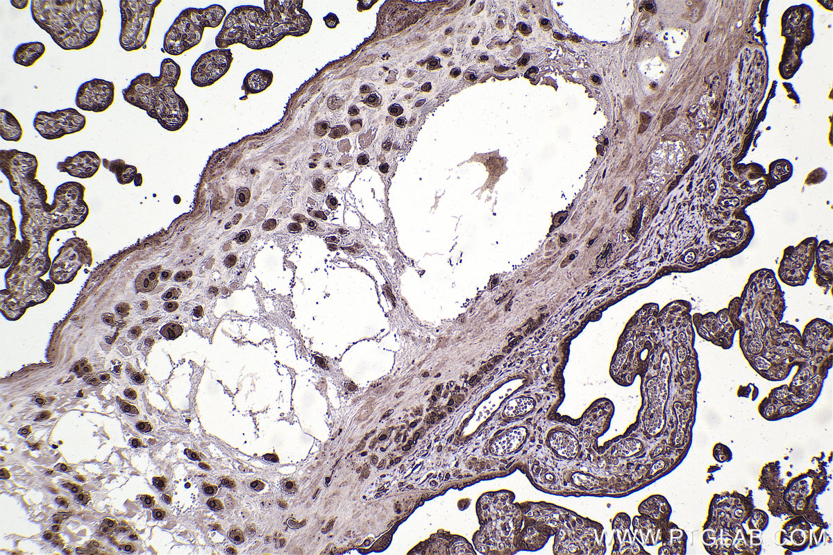 IHC staining of human placenta using 10469-1-AP