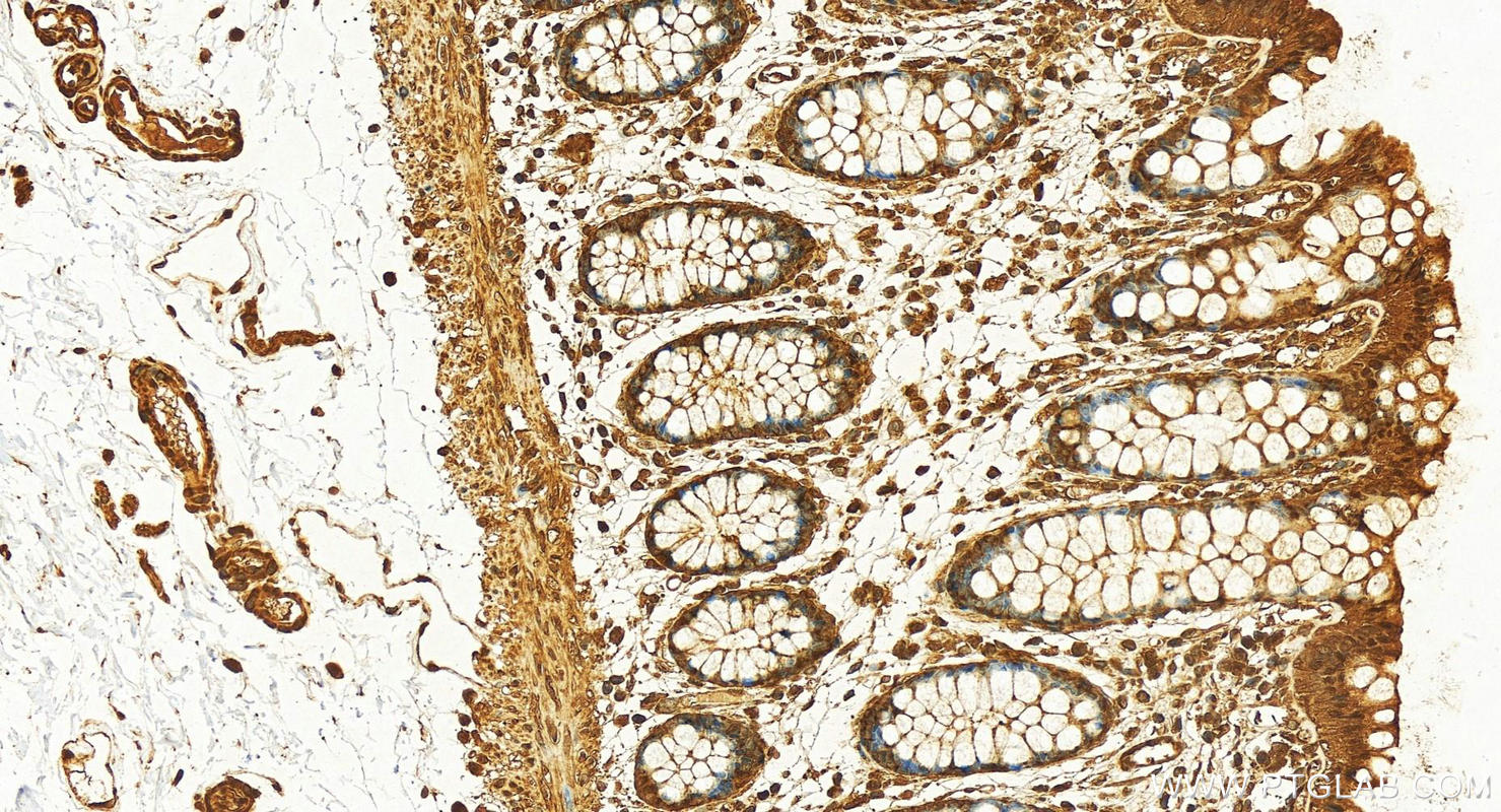 IHC staining of human colon using 82978-1-RR