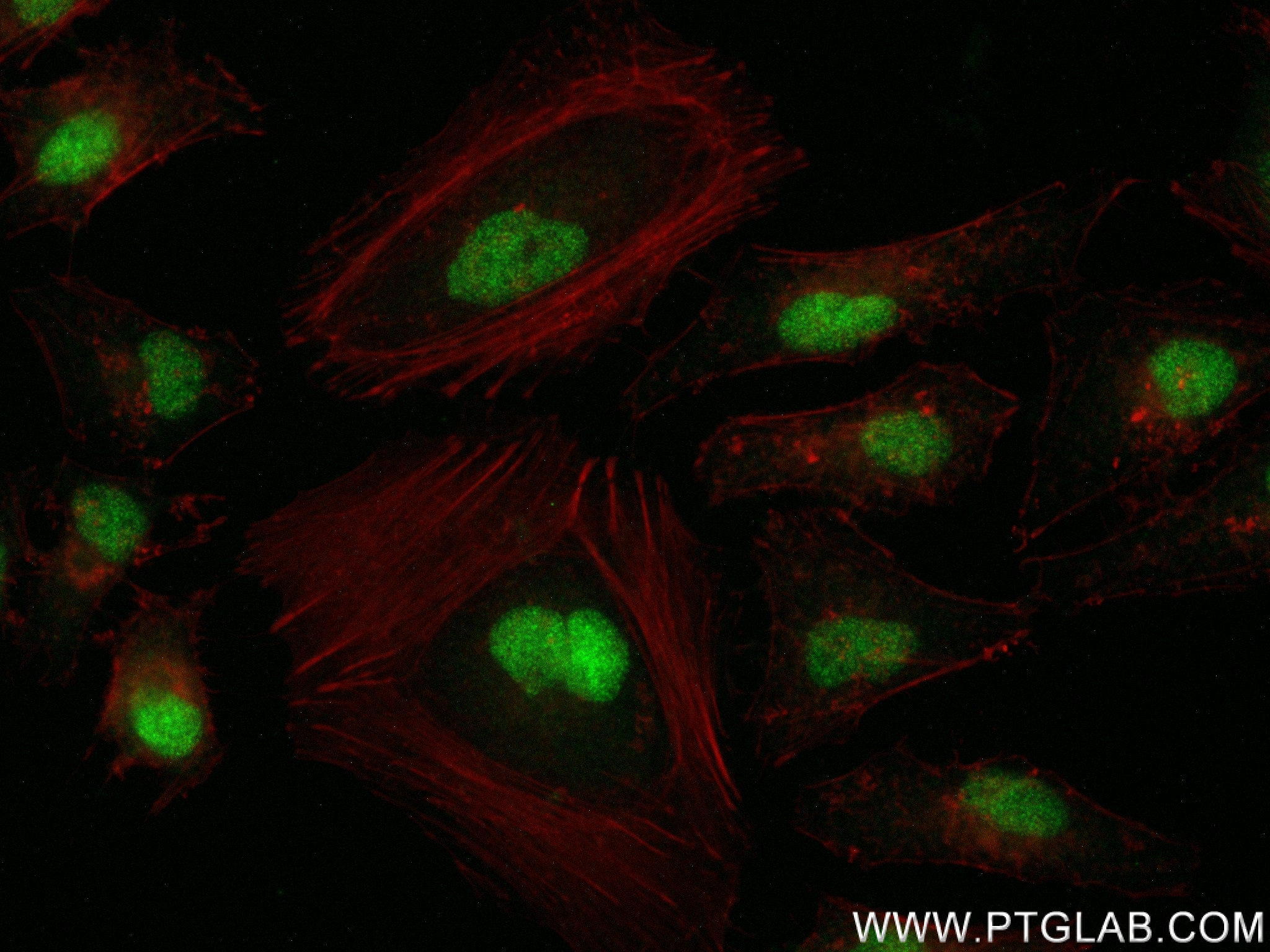 IF Staining of HeLa using 82978-1-RR