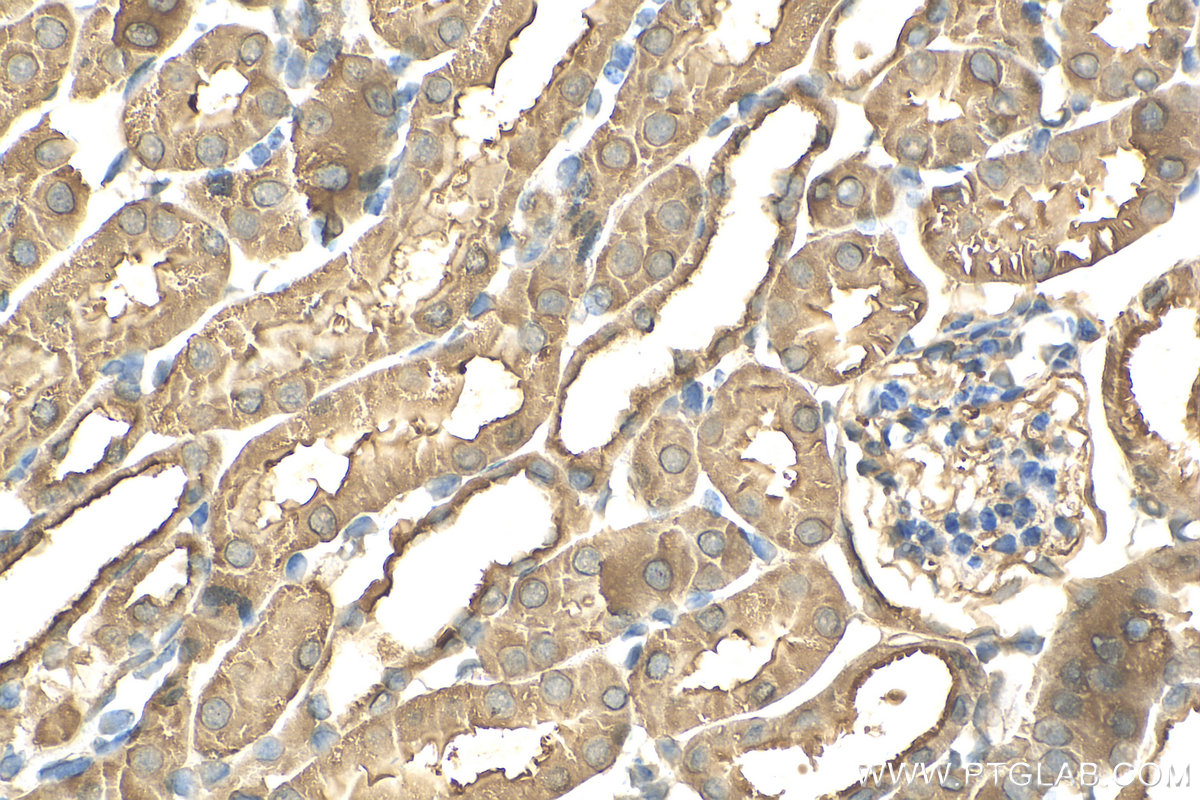 IHC staining of mouse kidney using 82978-1-RR