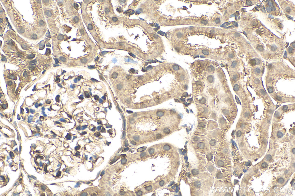 IHC staining of rat kidney using 82978-1-RR