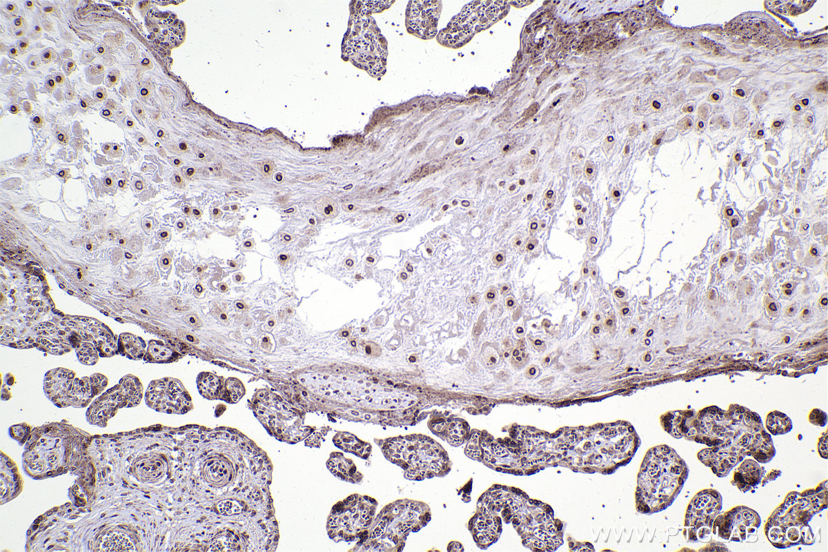 IHC staining of human placenta using 82978-1-RR