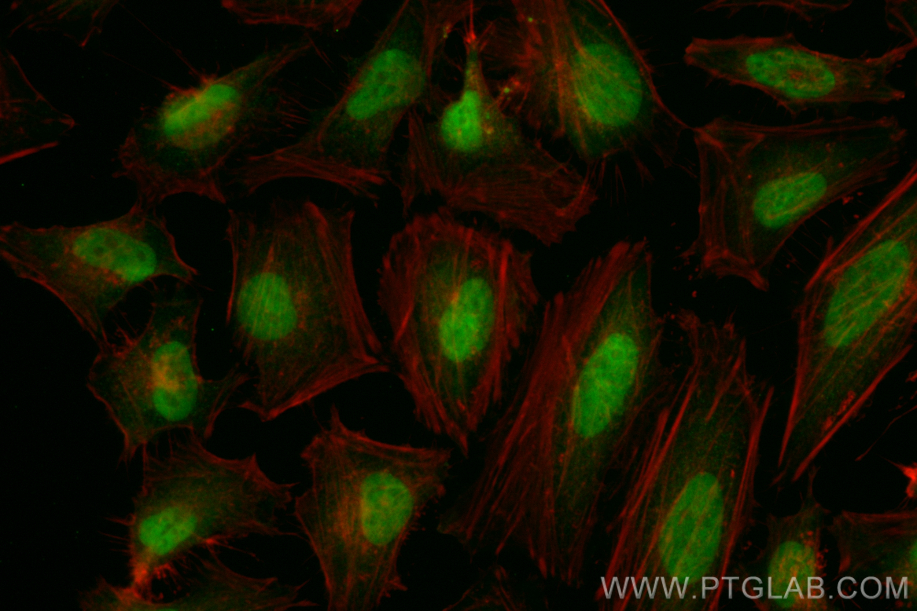 IF Staining of HeLa using CL488-82978