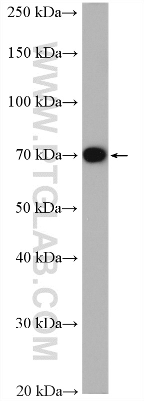 WB analysis of MCF-7 using 21107-1-AP