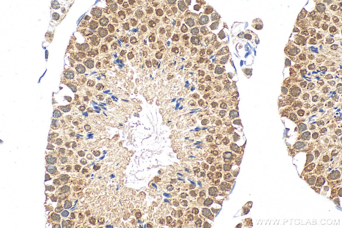 IHC staining of mouse testis using 27168-1-AP