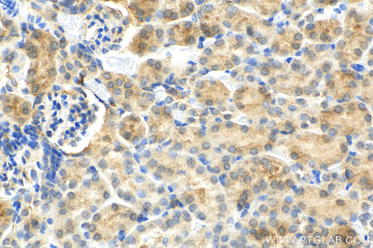 IHC staining of mouse kidney using 17875-1-AP