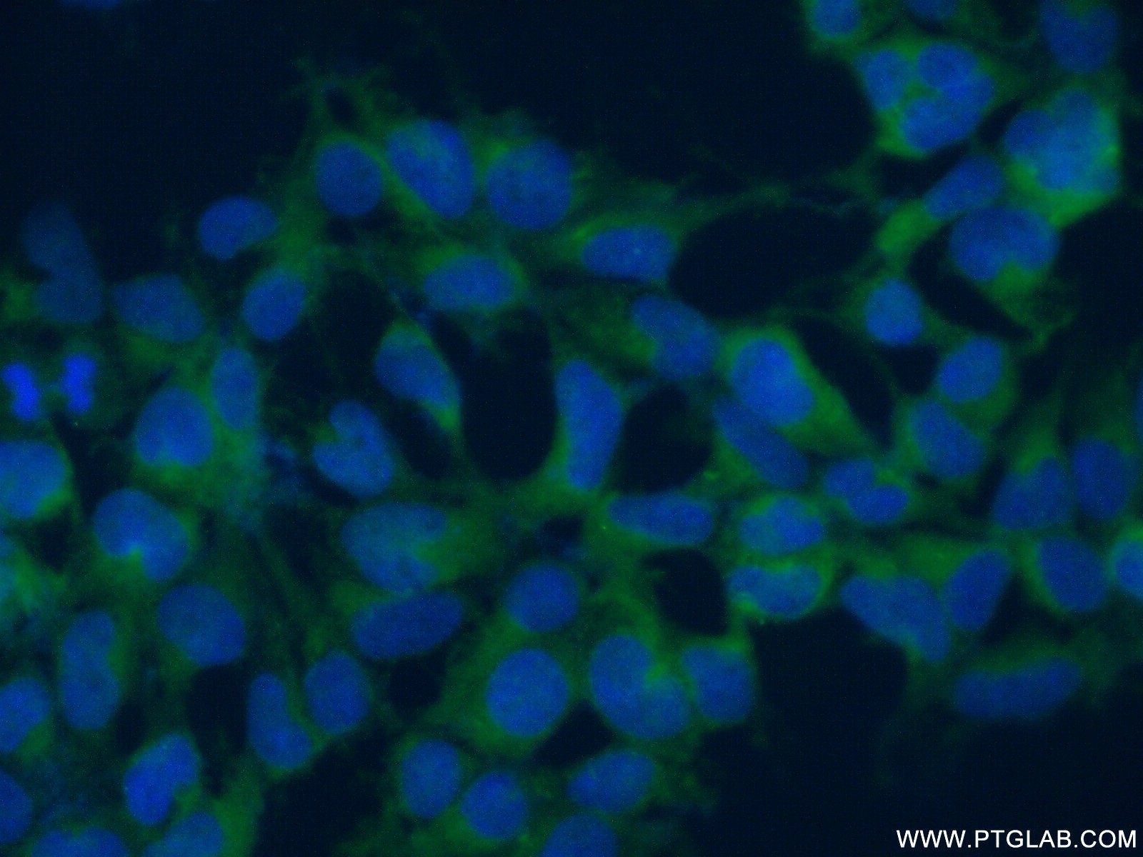 IF Staining of HEK-293 using 17656-1-AP