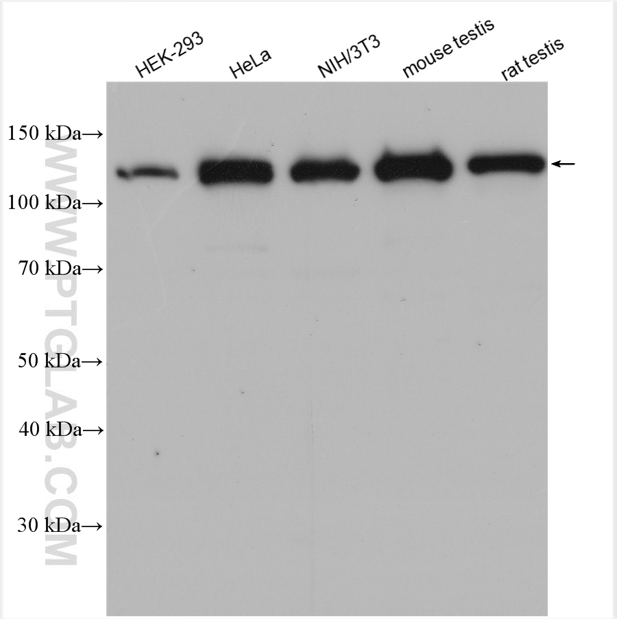 WB analysis using 17656-1-AP