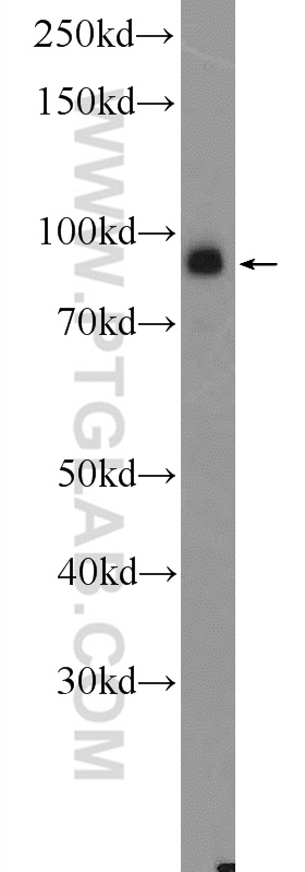 RANBP9 Polyclonal antibody