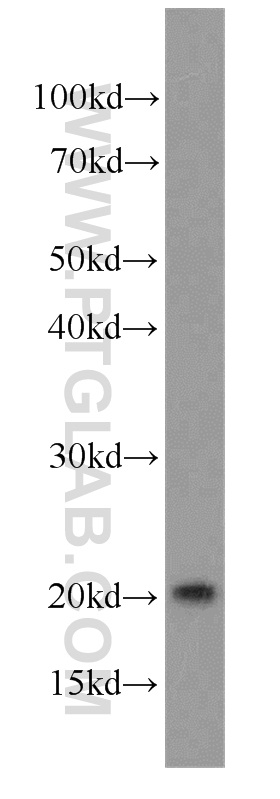 WB analysis of SGC-7901 using 10552-1-AP