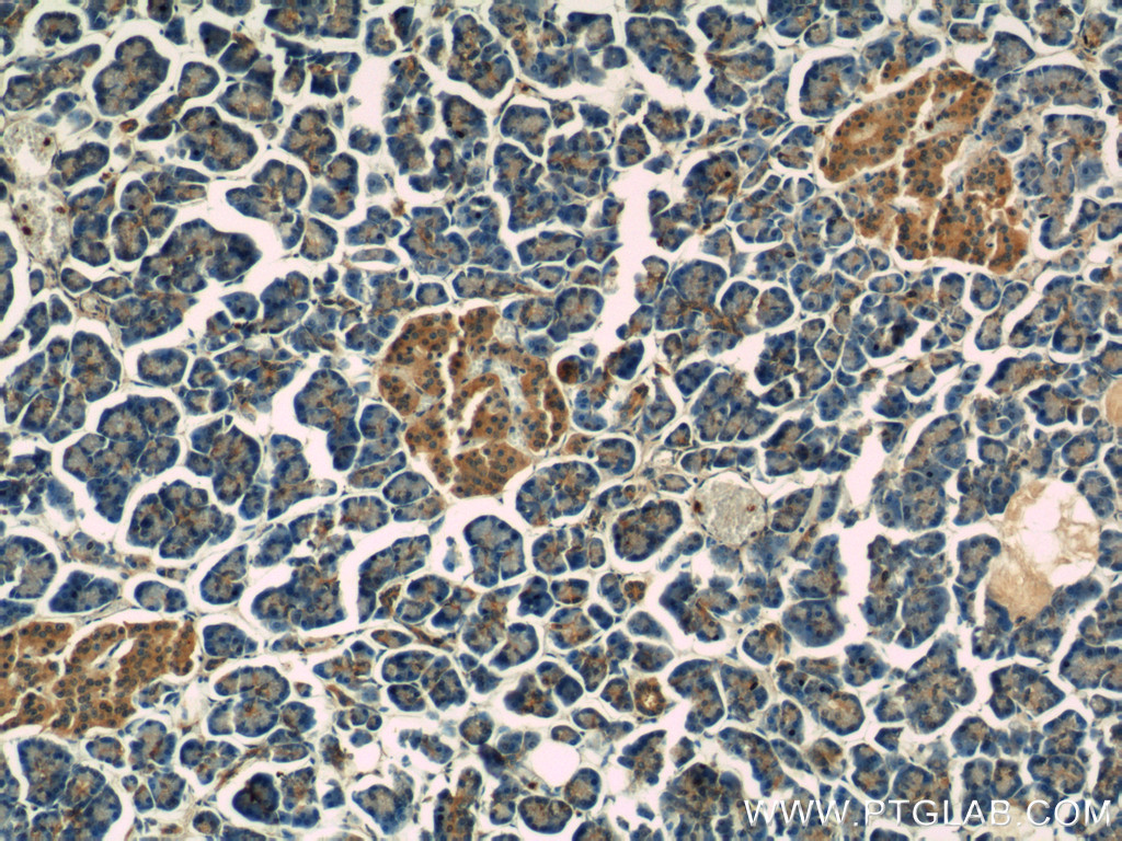 IHC staining of human pancreas using 14229-1-AP