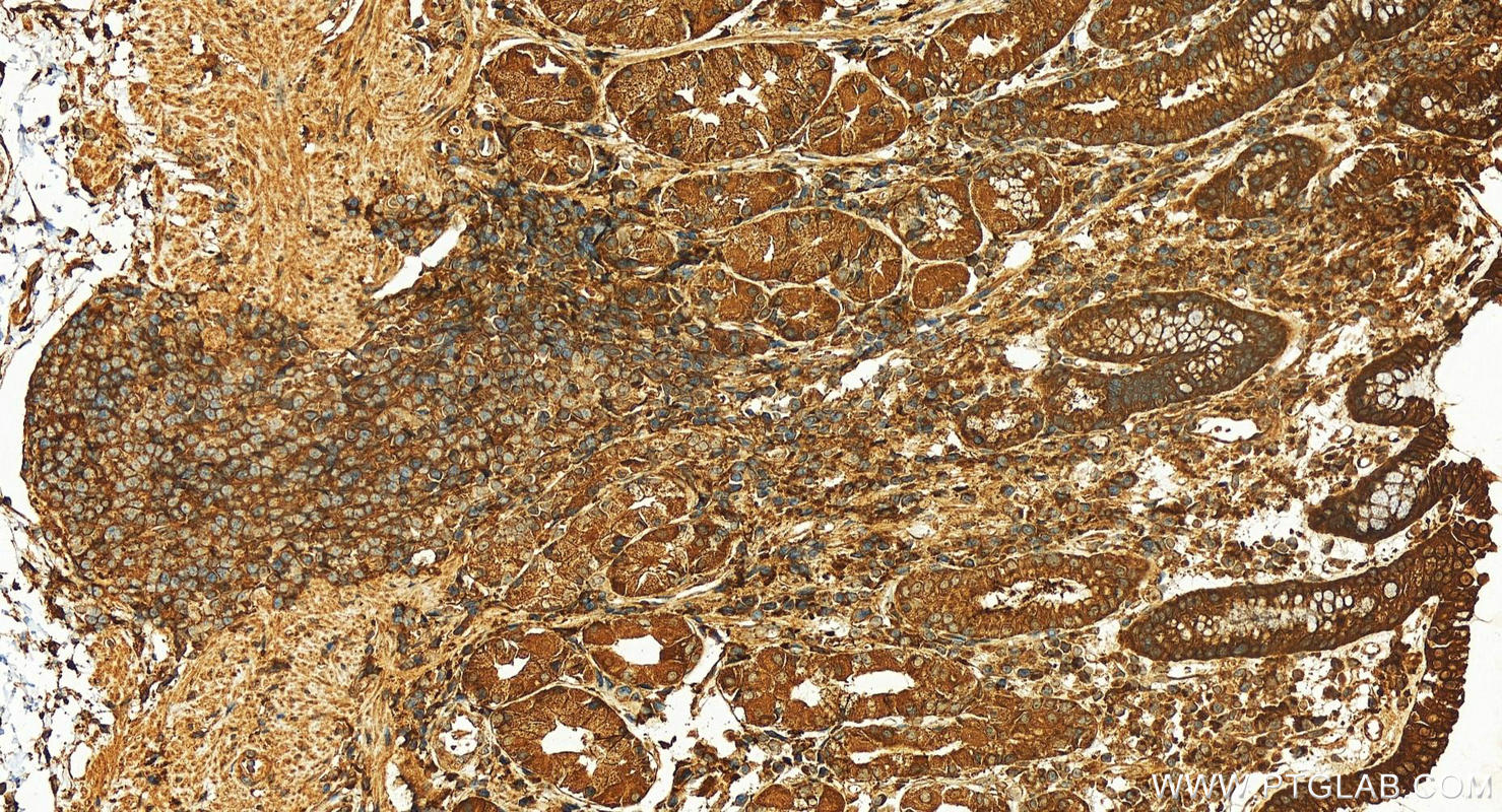 IHC staining of human stomach using 16266-1-AP