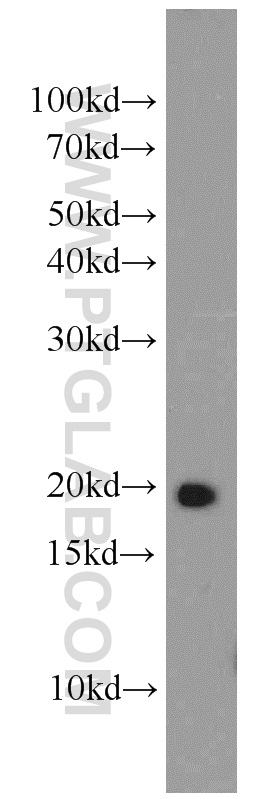 RAP2B Polyclonal antibody