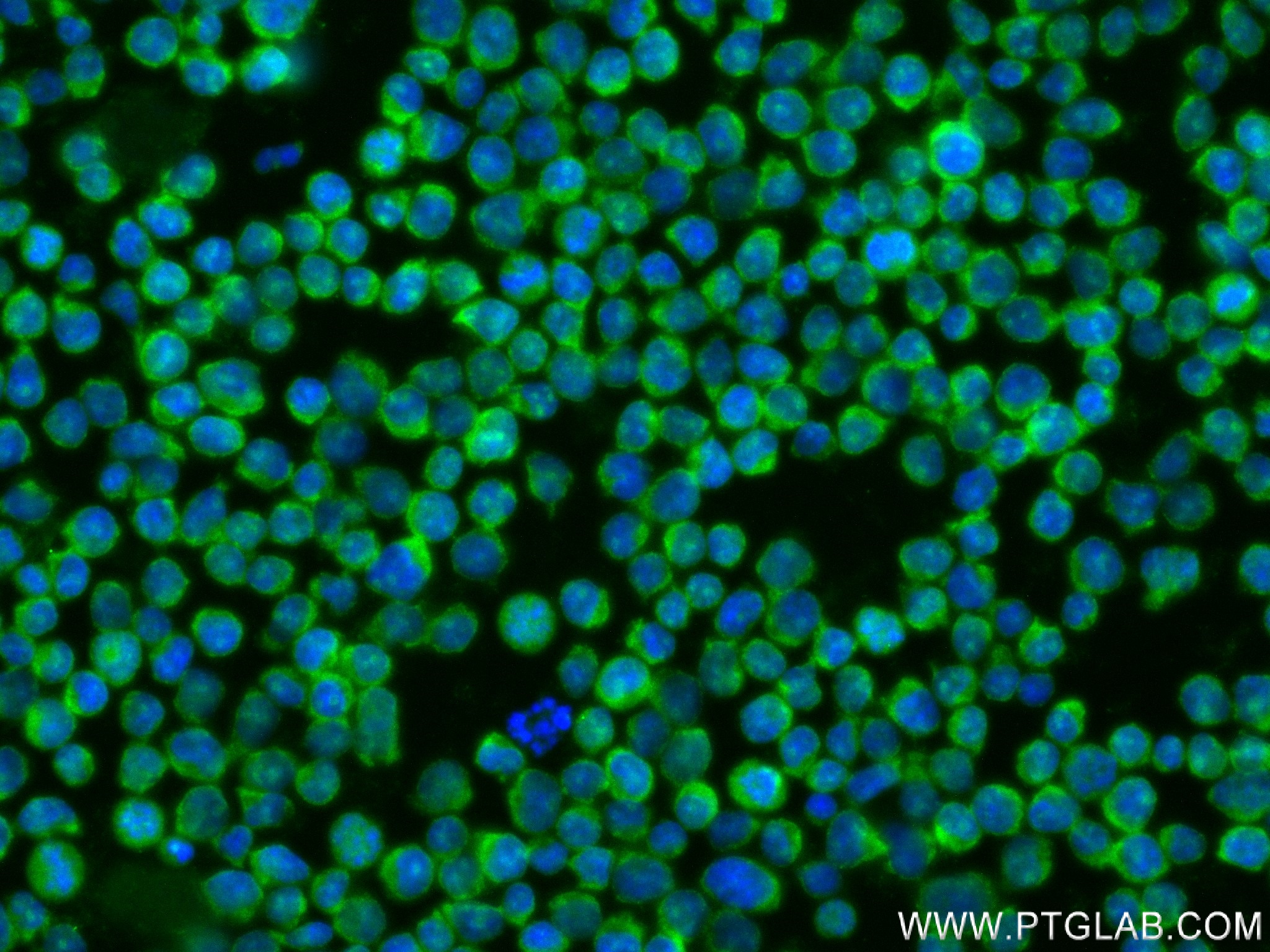 IF Staining of Jurkat using 84331-4-RR (same clone as 84331-4-PBS)