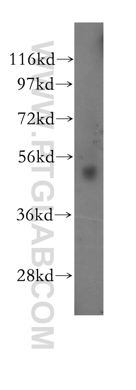 WB analysis of HeLa using 11424-1-AP