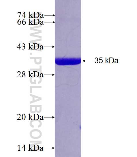 RARRES1 fusion protein Ag26547 SDS-PAGE