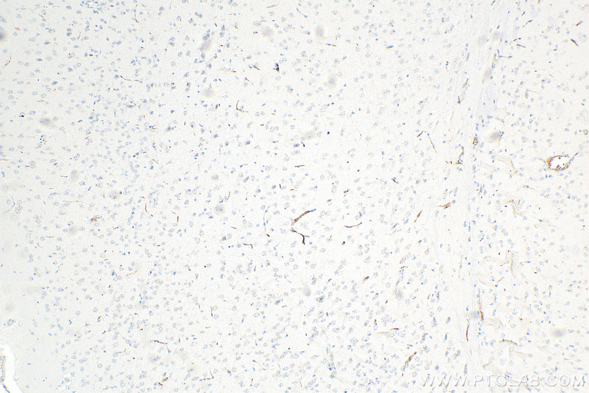 IHC staining of mouse brain using 66815-1-Ig (same clone as 66815-1-PBS)