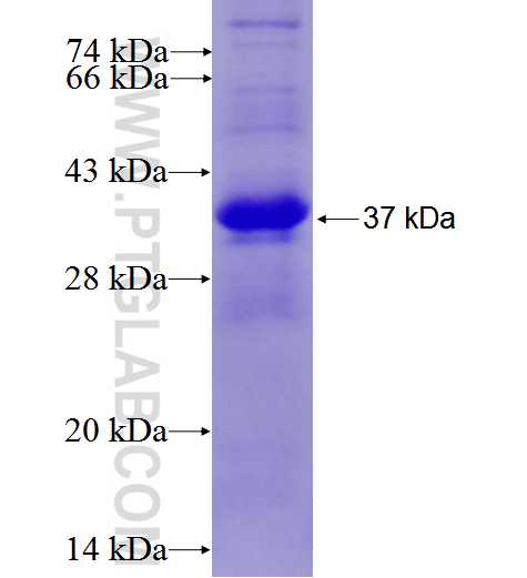 RASA3 fusion protein Ag27202 SDS-PAGE