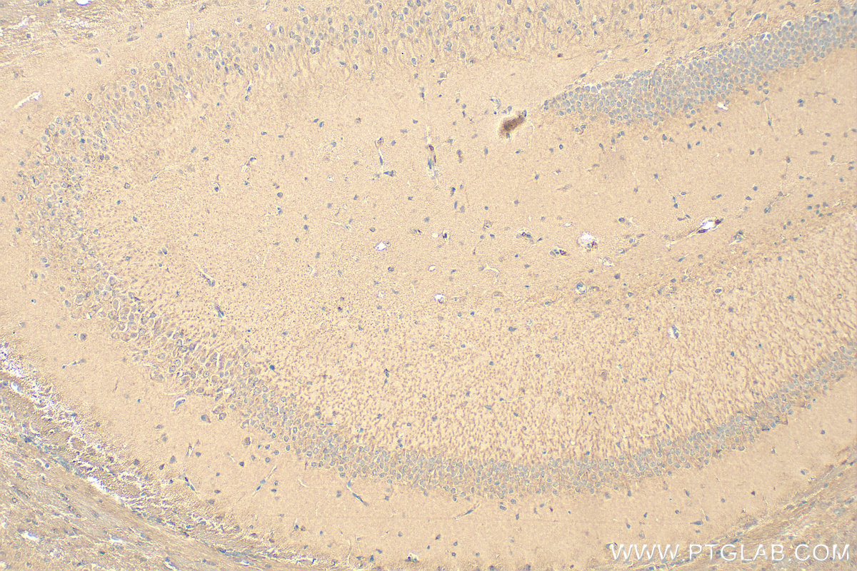 IHC staining of mouse brain using 11569-1-AP (same clone as 11569-1-PBS)