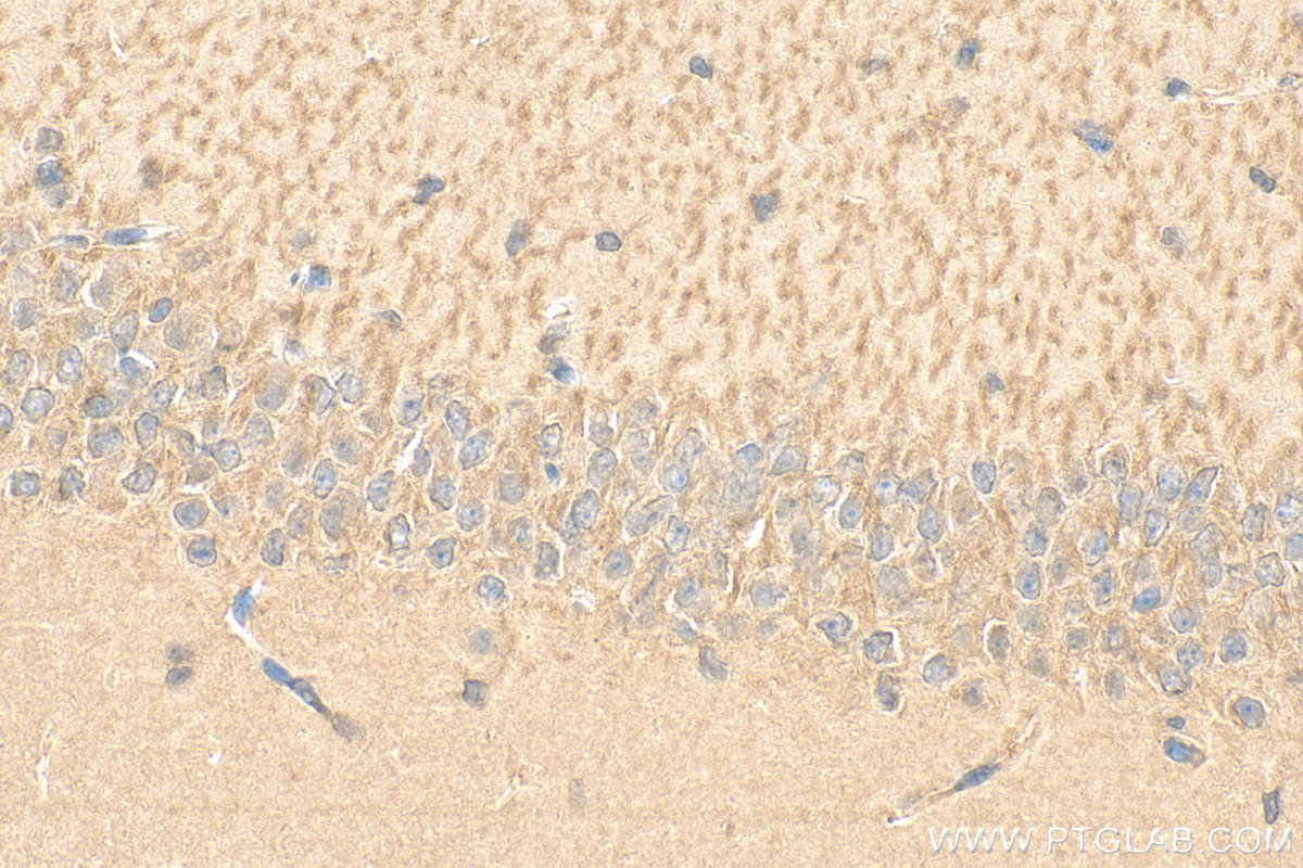 IHC staining of mouse brain using 11569-1-AP (same clone as 11569-1-PBS)