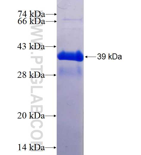RASGRP1 fusion protein Ag25725 SDS-PAGE