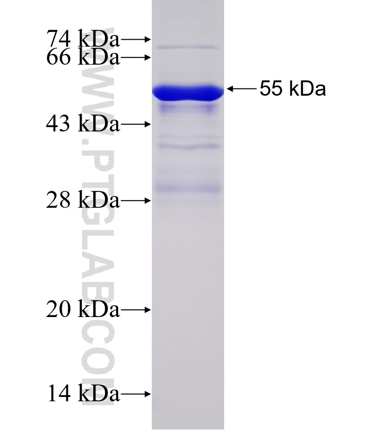 RASGRP2 fusion protein Ag32762 SDS-PAGE