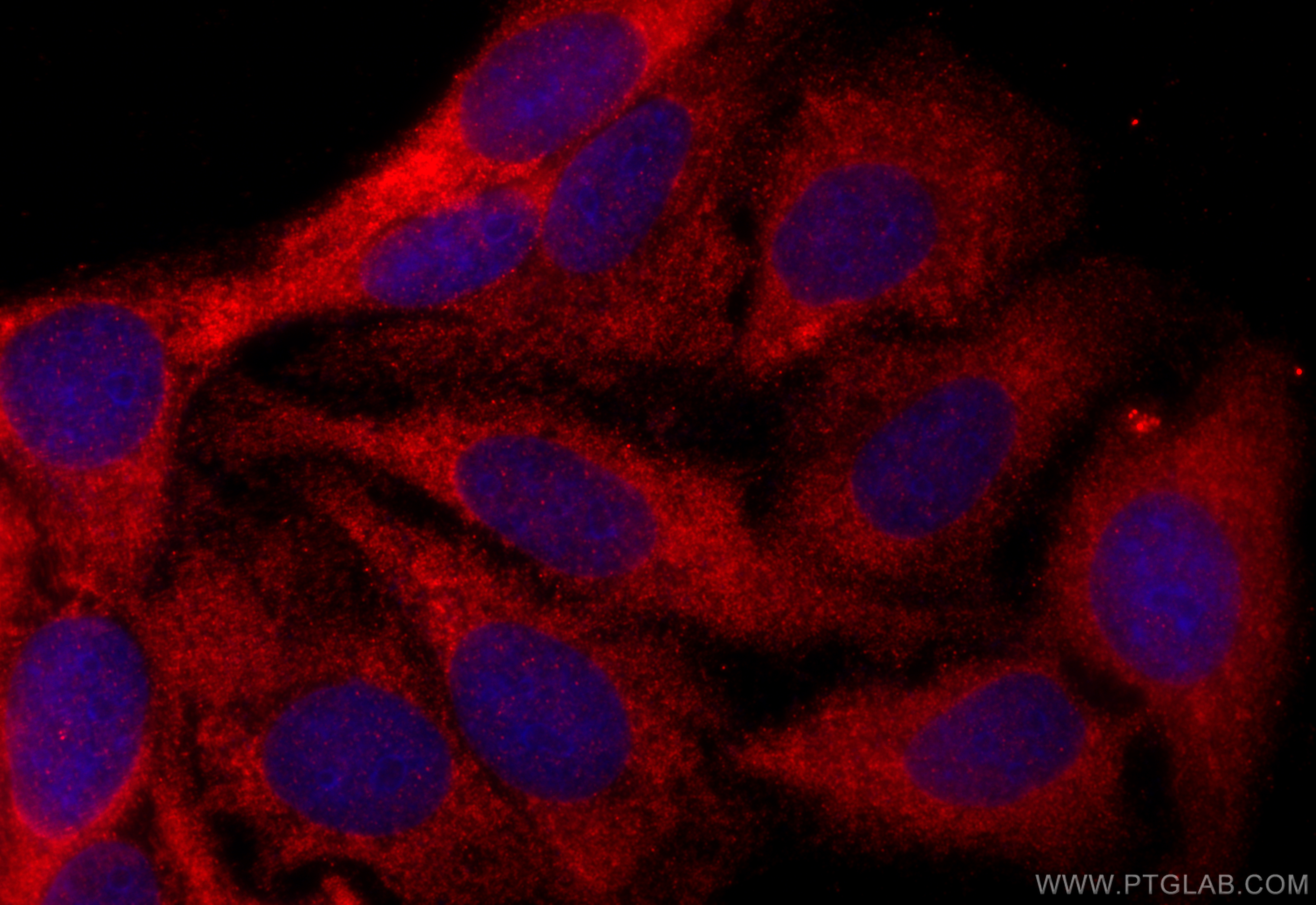 IF Staining of HepG2 using 26064-1-AP